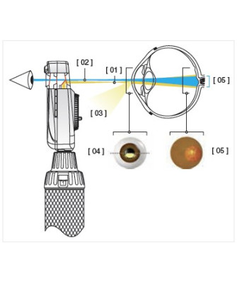 HEINE Système optique asphérique