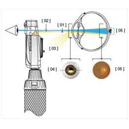 HEINE Système optique asphérique