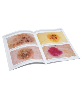 HEINE Compendium de dermoscopie