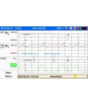 Moniteur fœtal jumeau Smart 3