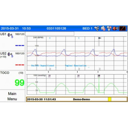 Moniteur fœtal jumeau Smart 3