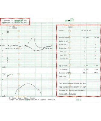 Zwillings-Fetalmonitor Smart 3