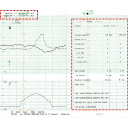Zwillings-Fetalmonitor Smart 3