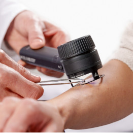 HEINE DELTA 30 PRO Dermatoskop Set