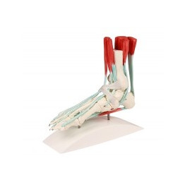 Les extrémités ou les articulations sont les bras, les jambes et les pieds